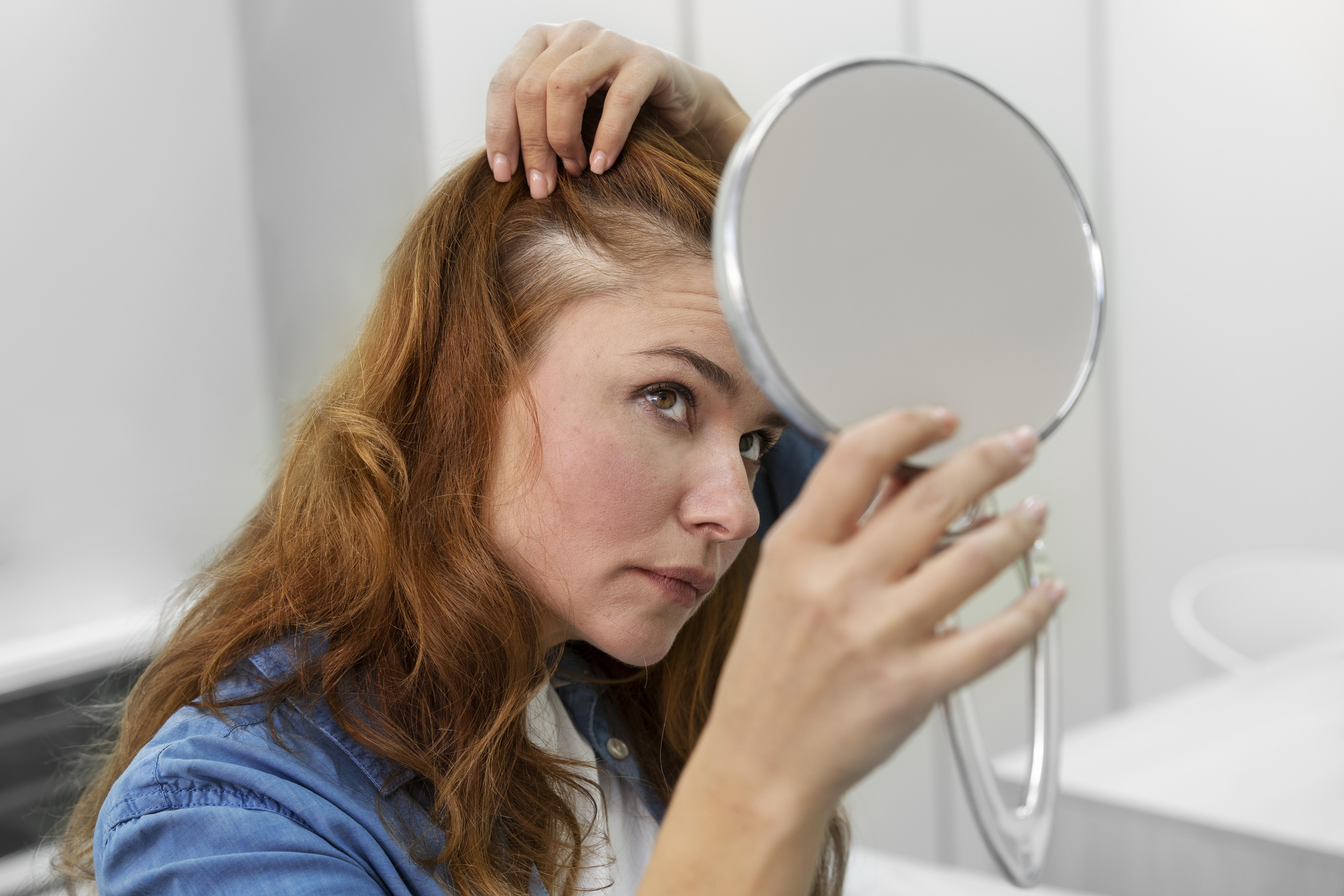 Try 100% Herbal made natural method for Hair Dandruff- Hurry Try 100% Herbal made natural method for Hair Dandruff- Hurry
